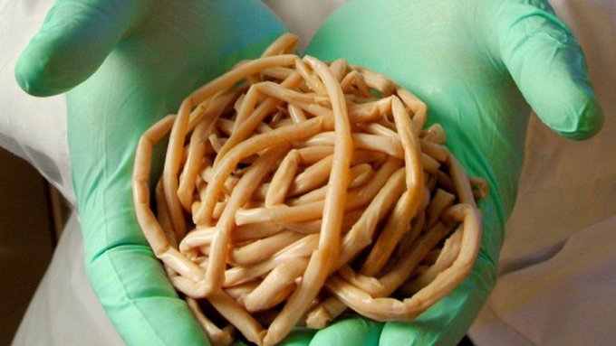 Extraen parásito intestinal de 40 centímetros a bebé de un año en Capiatá