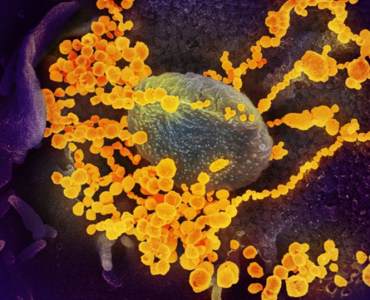 España reportó otra suba en la cifra de muertos y contagios de coronavirus: 757 fallecidos y 6.180 nuevos casos
