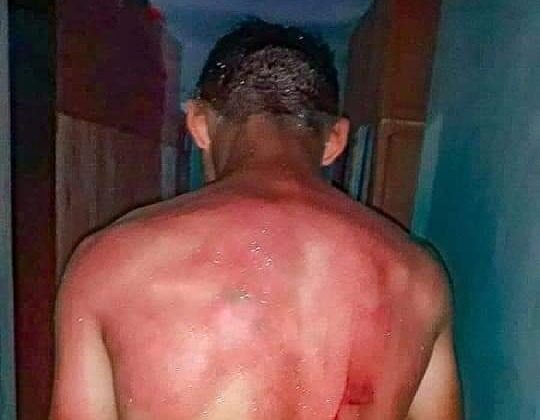Terrible caso de esclavitud y maltrato: “Adolescente trabaja para comer”