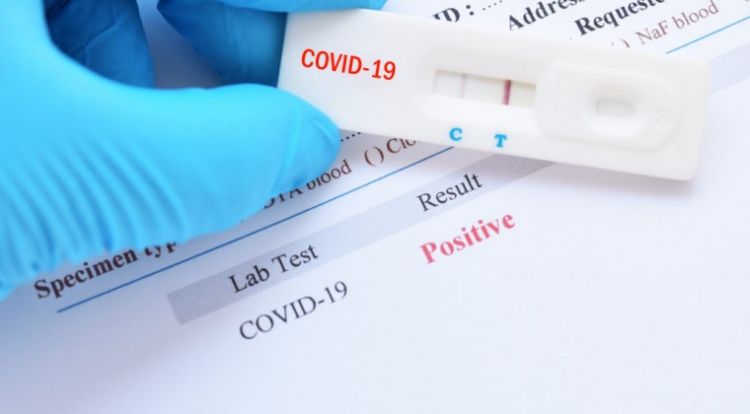 Confirman 952 casos positivos de COVID-19 y suman otros 14 fallecidos