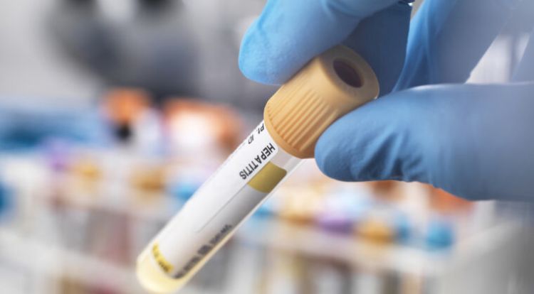 Detectan el primer caso de hepatitis infantil desconocida en Argentina