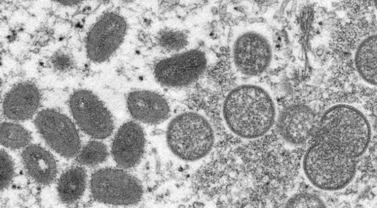 Viruela del mono: OMS informa que se han registrado 131 casos en 19 países