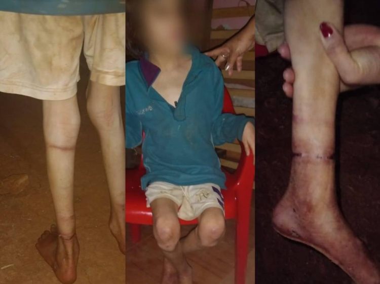 Inhumano: atada y desnutrida, niña es rescatada de su madre