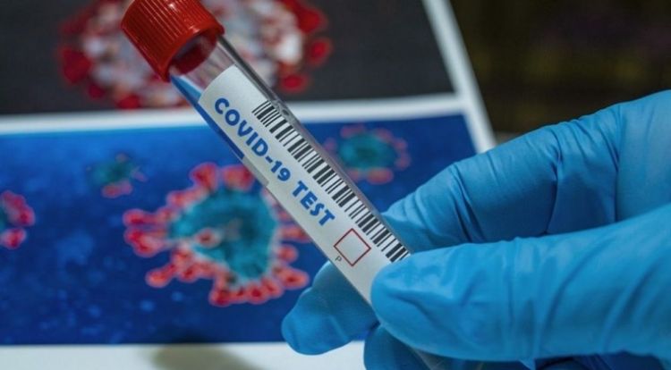 Números rojos del COVID-19: reportan casi 500 casos, con 269 sin nexo y otros 7 fallecidos