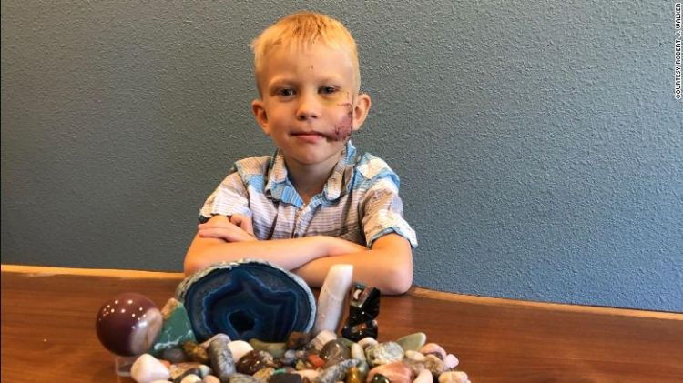 Niño de 6 años salva a su hermanita del ataque de un perro y conquista las redes sociales tras felicitación de Anne Hathaway