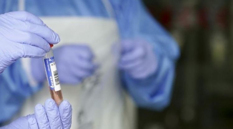 Brasil supera las 220.000 muertes por COVID-19 y roza los 9 millones de casos