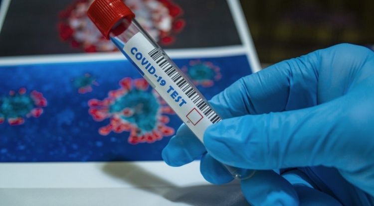 Confirman 58 nuevos casos y cuatro fallecidos por COVID-19