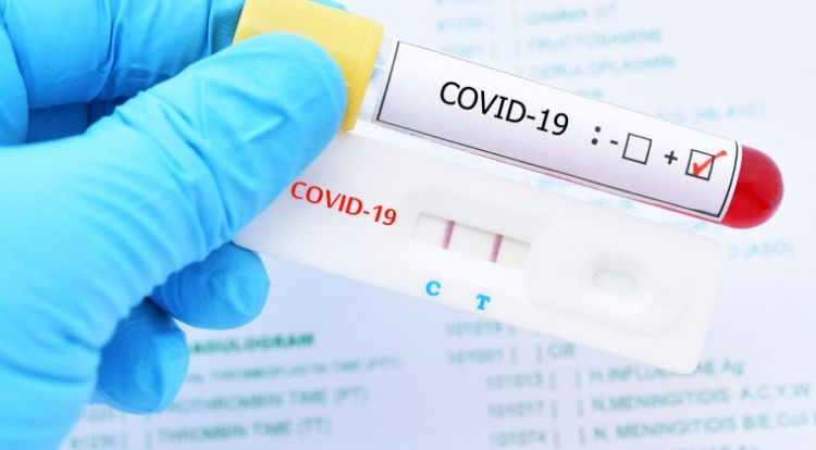Confirman 554 casos positivos y 15 muertes por COVID-19: situación sigue delicada en UTI