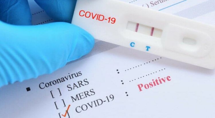 Reportan 115 casos positivos y 9 fallecidos por COVID-19