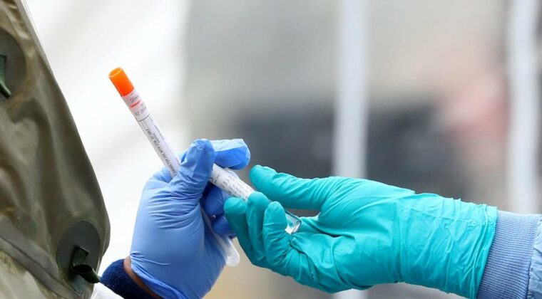 Reportan 54 casos y 1 fallecido por COVID-19 en una semana