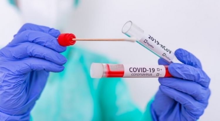 Confirman 760 casos de COVID-19 y 14 nuevos decesos: total de muertes llega a 1.373