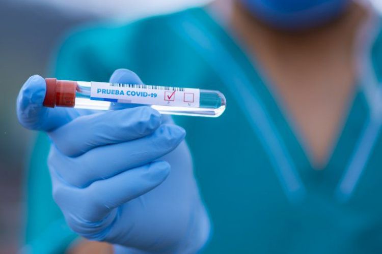 Covid-19: Salud informa sobre 16 fallecidos y 657 nuevos contagios