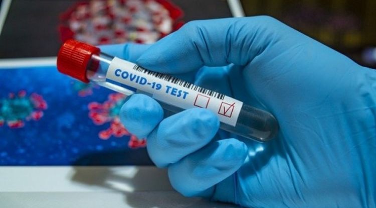 Contagios laborales: 40 en frigorífico, 63 en súper y 19 en fábrica de embutidos