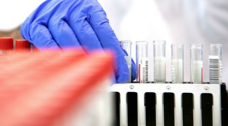 Científicos chinos presentan nuevo test anticovid ultrarrápido