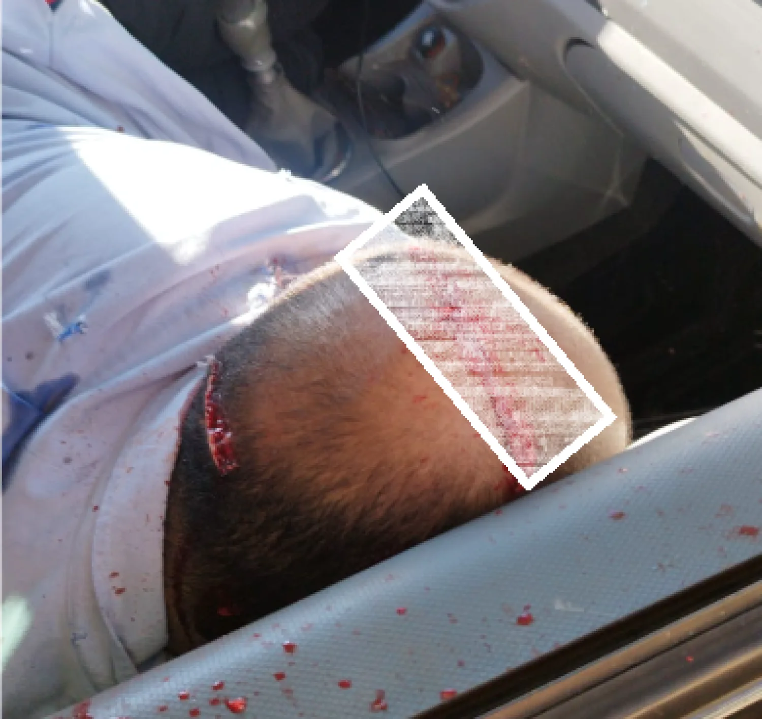 Asesinan a tiros a un hombre dentro de su vehículo en la zona del Hemocentro en Ponta Porã