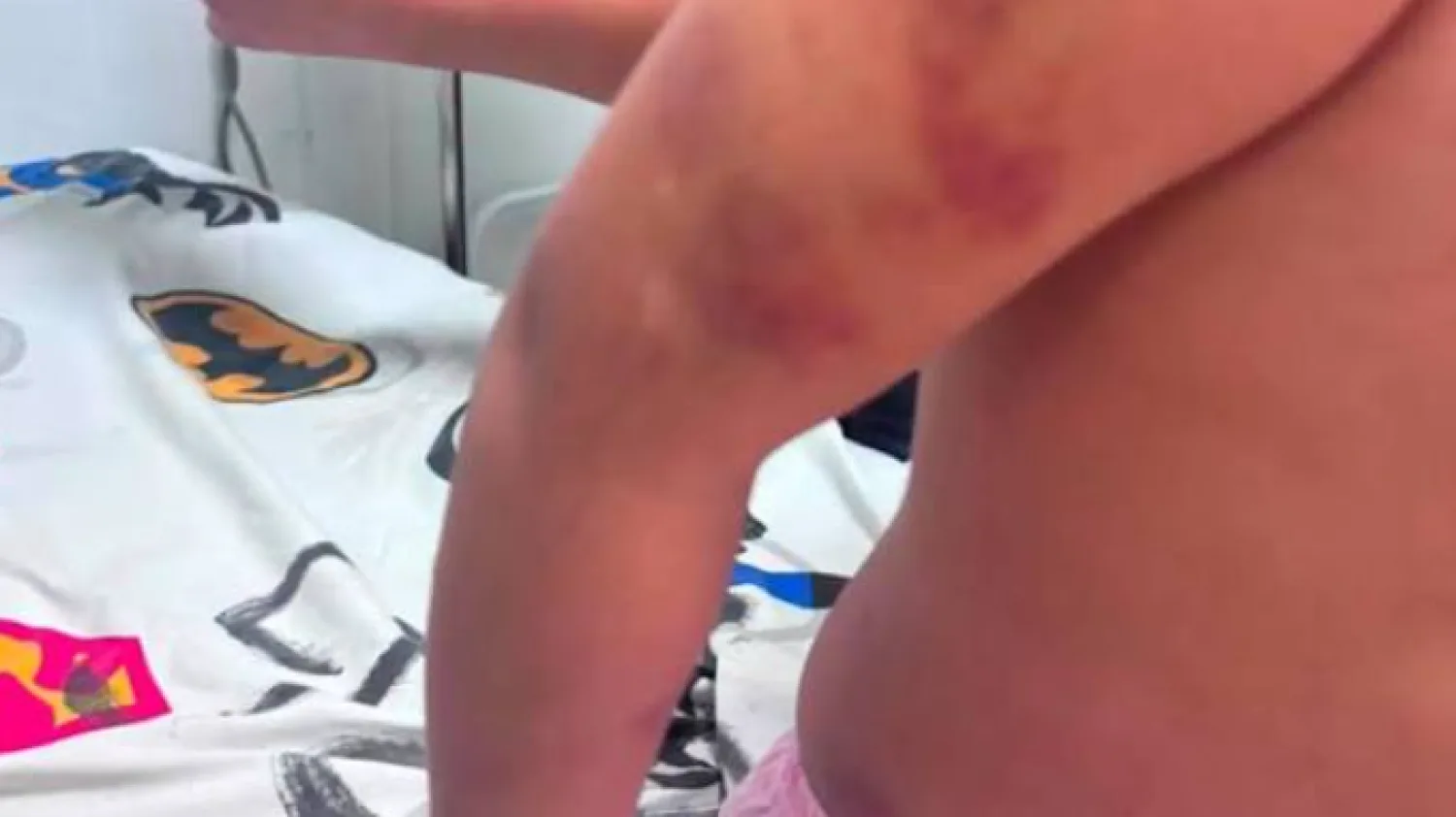 Otorgan la custodia provisional de niña maltratada por su padrastro a una pareja de pastores y causa indignación