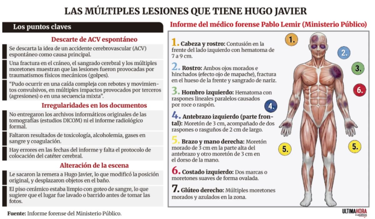 Informe forense descarta caída simple de Hugo Javier y refuerza hipótesis de agresión
