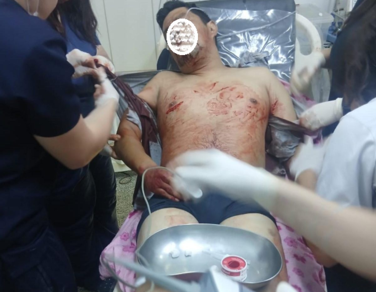 Hombre resulta herido de gravedad tras ataque con arma blanca en Fracción Reyes Católicos